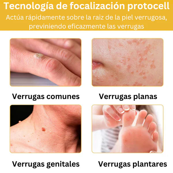 Encabezado