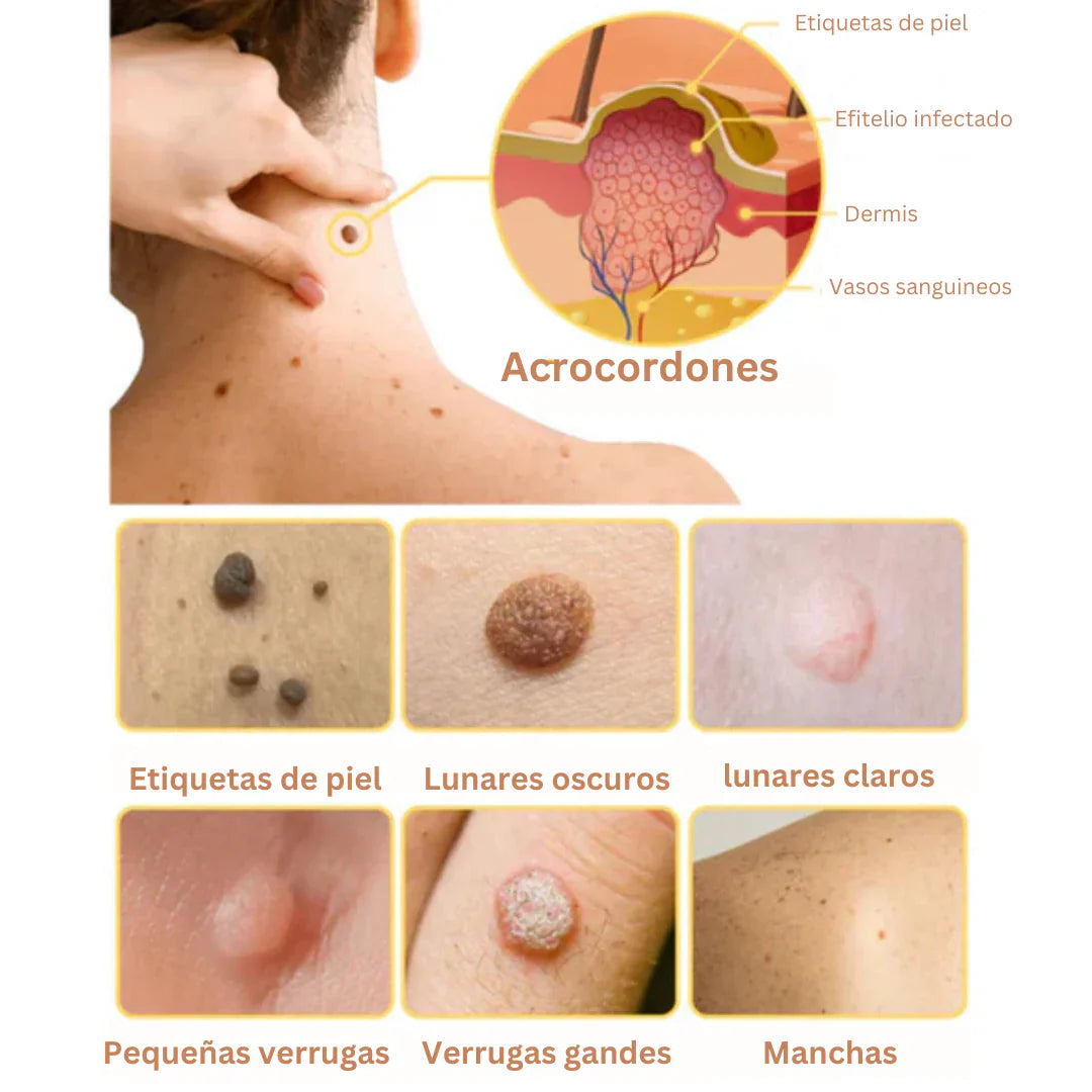 Encabezado