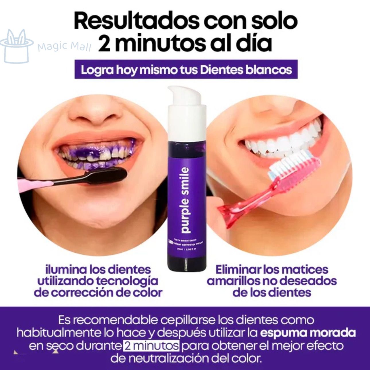 💜SmileKit Purple Glow® – Blanquea tus dientes de forma natural y sin sensibilidad🦷